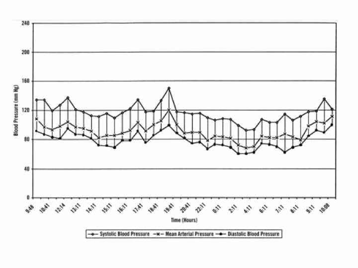 BP graph